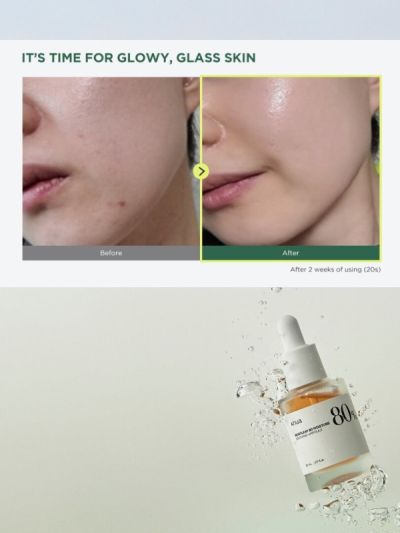 Серум за лице ANUA Heartleaf 80% soothing ampoule
