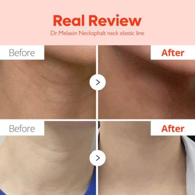 Крем за шия Dr.Melaxin Necklinephalt Neck Cream 20 ml